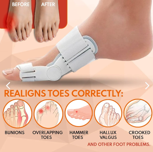 👣✨ PAR CORRECTOR DE JUANETES ORTOPÉDICOS ✨👣