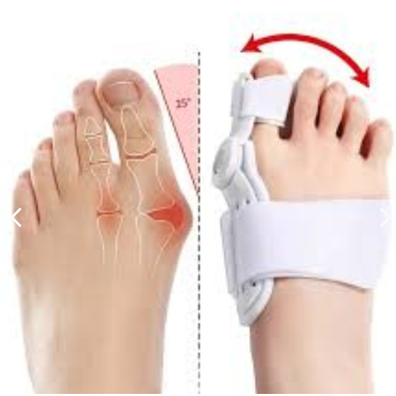 👣✨ PAR CORRECTOR DE JUANETES ORTOPÉDICOS ✨👣