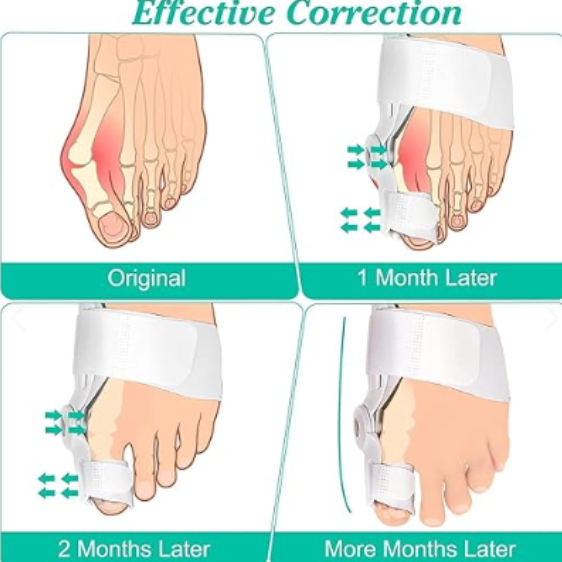 👣✨ PAR CORRECTOR DE JUANETES ORTOPÉDICOS ✨👣