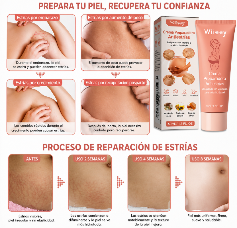 🌸 SKIN REVIVE MAMA- QUITA ESTRIAS✨
