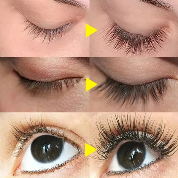 Fast-Eyelash-Growth-Serum-5-Days-Natural-Eyelash-Enhancer-Longer-Fuller-Thicker-Lashes-Treatment-New-Products.jpg